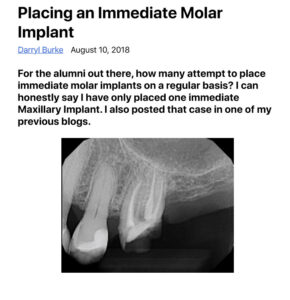 Placing an Immediate Molar Implant