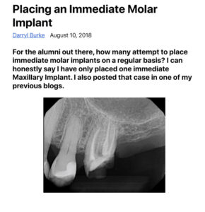 Placing an Immediate Molar Implant