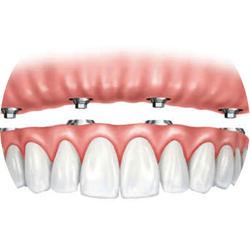 Graphic image of dentures
