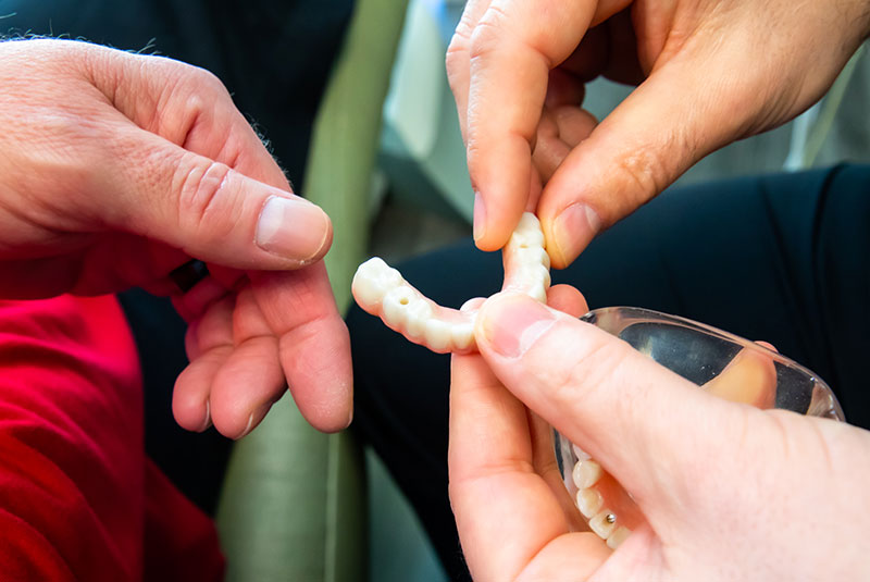 model of dental implant being displayed