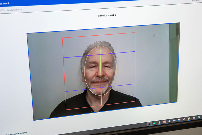 Patient having their picture taken for dental procedure within the dental office